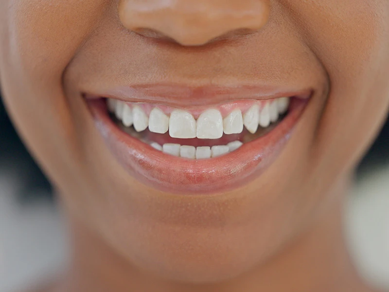 Qué es la ortodoncia - Dentista en Soria